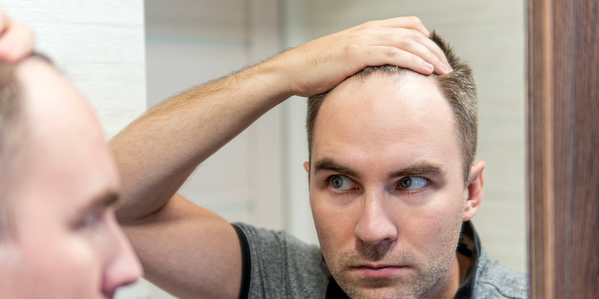 How to Stop Hair Loss Before It’s Too Late