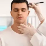 A man wearing a white shirt with closed eyes, while a gloved medical professional marks his hairline with a pen.