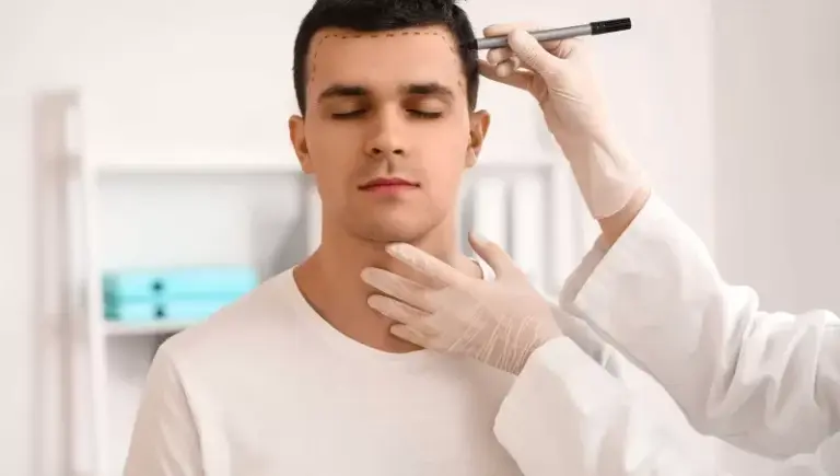 A man wearing a white shirt with closed eyes, while a gloved medical professional marks his hairline with a pen.